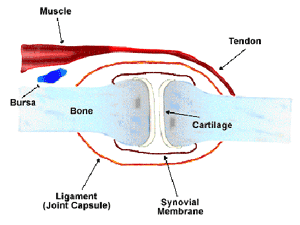 Arthritis: What is it?